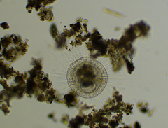 Actinosphaerium eichhornii
