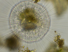 Actinosphaerium eichhornii