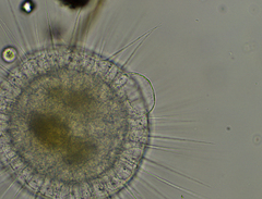 Actinosphaerium eichhornii