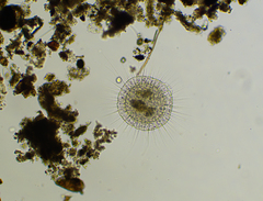 Actinosphaerium eichhornii