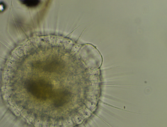 Actinosphaerium eichhornii