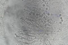 Clavulinopsis sulcata