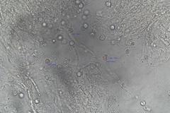 Clavulinopsis sulcata