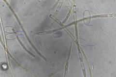 Cheilymenia raripila
