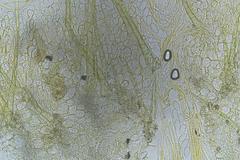 Cheilymenia raripila