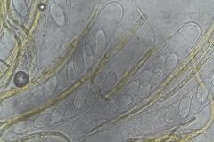 Cheilymenia raripila