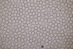 Microbotryum scabiosae