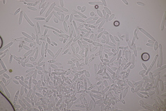 Ramularia parietariae