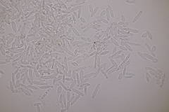 Ramularia parietariae