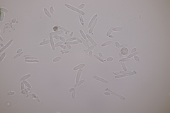 Ramularia parietariae