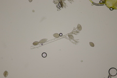 Peronospora violacea