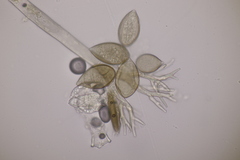 Peronospora violacea