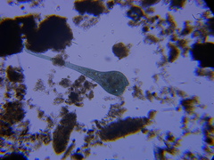 Stentor coeruleus