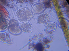 Vorticella