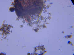 Vorticella