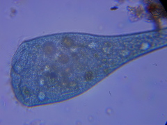 Stentor coeruleus