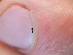 Heliothrips haemorrhoidalis