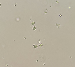 Pseudoomphalina