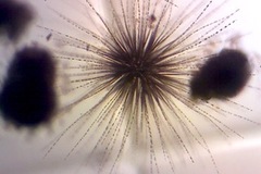 Gloeotrichia echinulata