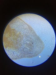 Macrostomum