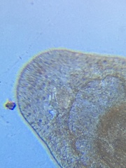 Macrostomum