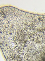 Macrostomum