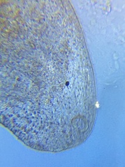 Macrostomum