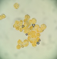 Synchytrium minutum