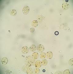 Synchytrium minutum