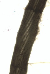 Vertebrata fucoides