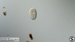 Ophryoglena