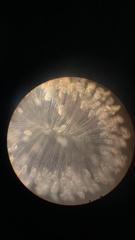 Conochilus hippocrepis