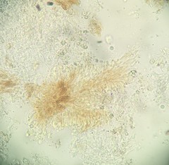 Steccherinum ciliolatum