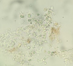 Steccherinum ciliolatum