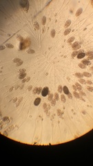 Conochilus hippocrepis