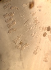 Conochilus hippocrepis