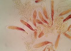 Bryostroma trichostomi