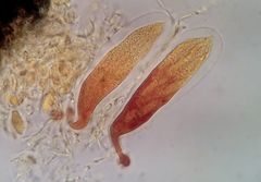 Bryostroma trichostomi