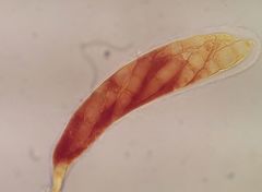 Bryostroma trichostomi