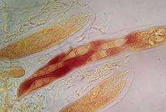 Bryostroma trichostomi