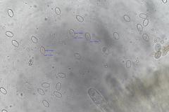 Pseudombrophila theioleuca