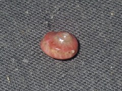 Notogibbula bicarinata