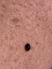 Hyperaspis bigeminata