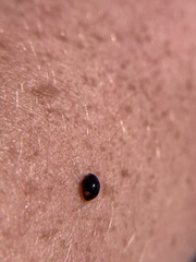 Hyperaspis bigeminata