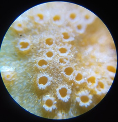 Puccinia dioicae silvatica