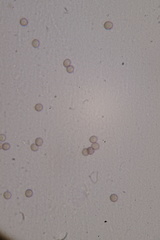 Microbotryum violaceum