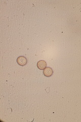 Microbotryum violaceum