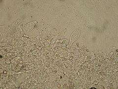 Pluteus semibulbosus