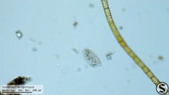 Pleuronema coronatum