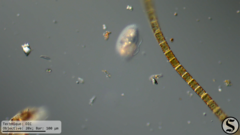 Pleuronema coronatum